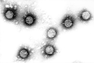 Папилломавируси инсон